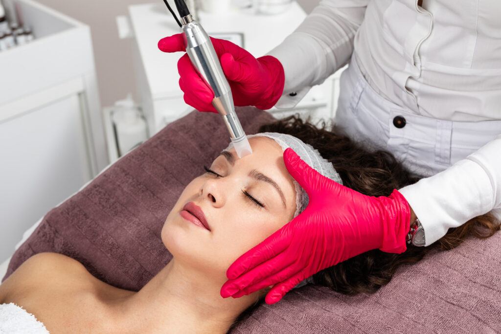 Microneedling Treatment | Beauty Couture Aesthetics and Wellness in San Antonio, TX